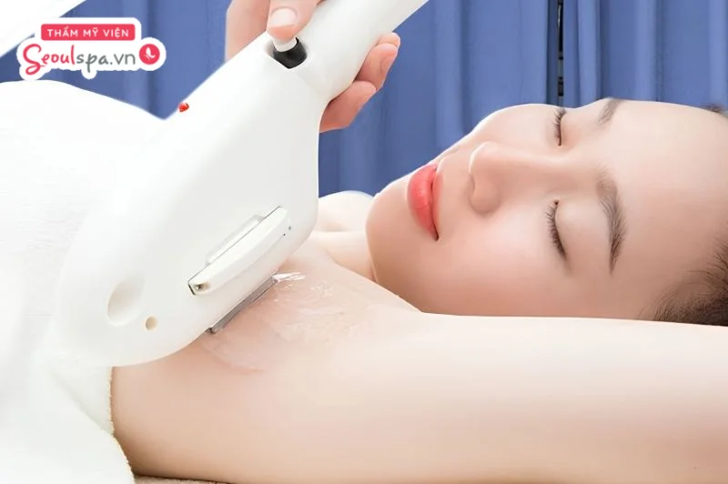 Khách hàng thực hiện triệt lông bằng công nghệ hiện đại, giúp mang đến làn da dưới cánh tay mịn màng