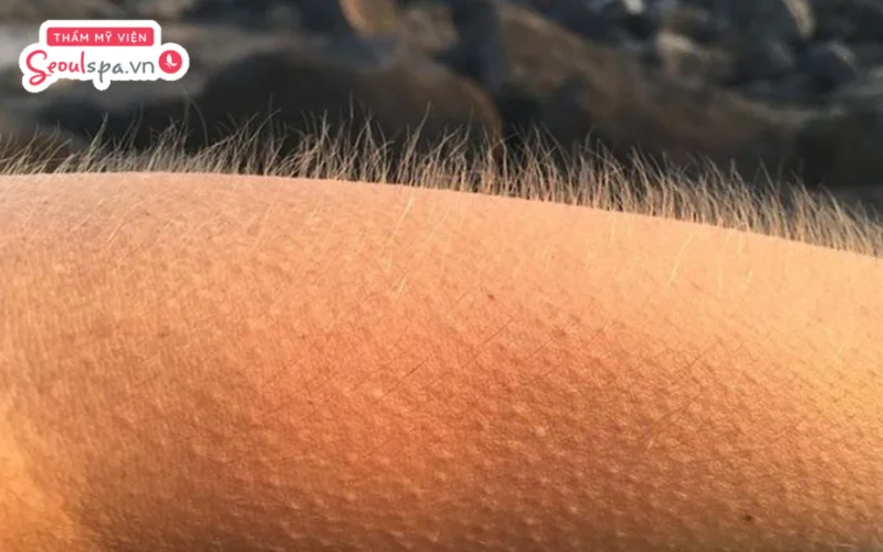 Lông tay trở nên dựng đứng