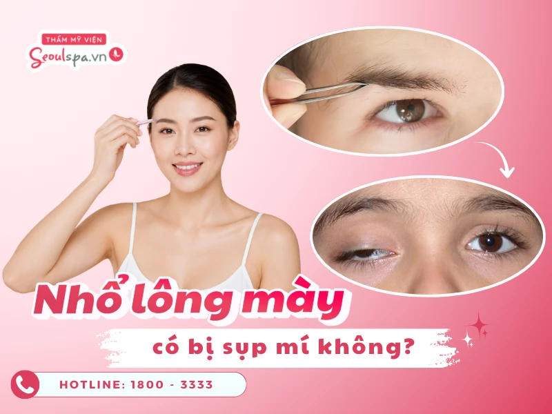 Nhổ lông mày có bị sụp mí không