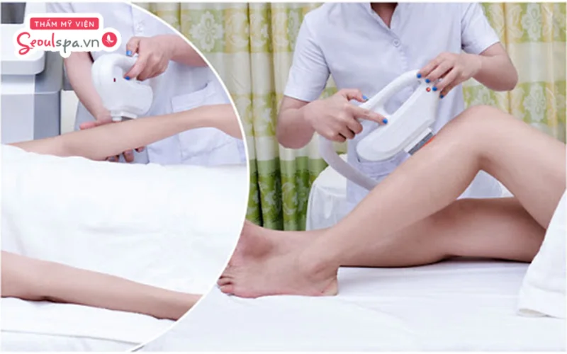 Công nghệ làm sạch lông OPT