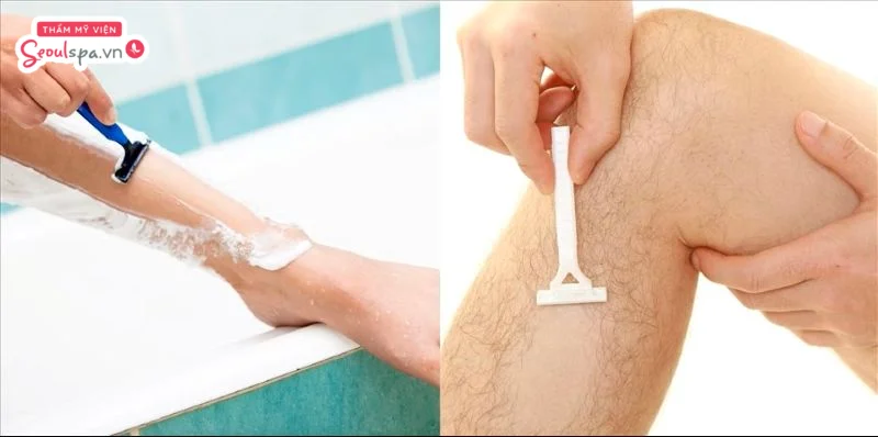 Cạo lông chân bằng dao cạo giúp loại bỏ lông nhanh chóng nhưng chỉ mang lại hiệu quả tạm thời.