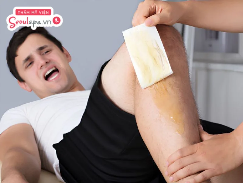 Wax lông bằng sáp giúp loại bỏ lông từ gốc nhưng có thể gây cảm giác đau rát.