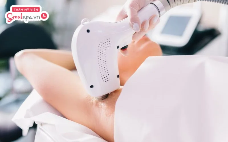 Vùng nách và bikini thường nhạy cảm hơn nên có thể xuất hiện cảm giác châm chích nhẹ khi triệt lông.