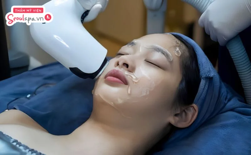 Chuyên viên thực hiện liệu trình triệt lông lạnh theo quy trình chuẩn giúp nâng cao hiệu quả triệt lông và bảo vệ làn da. 