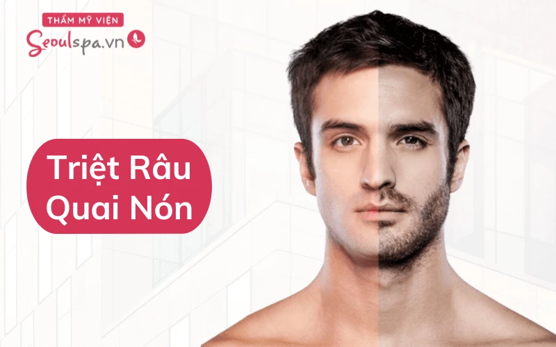 SeoulSpa.Vn - Địa chỉ triệt râu nam vĩnh viễn an toàn, hiệu quả lâu dài