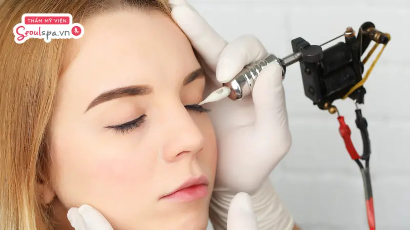Công nghệ laser hiện đại giúp phá vỡ các liên kết hạt mực cũ dưới da một cách an toàn