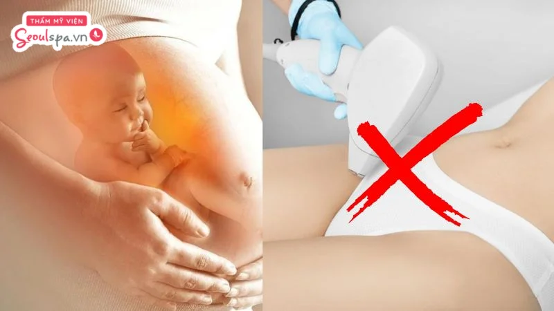 Phụ nữ đang mang thai nên tạm dừng triệt lông trong thai kỳ vì nội tiết thay đổi có thể khiến da nhạy cảm hơn, đồng thời ưu tiên an toàn cho mẹ và bé.