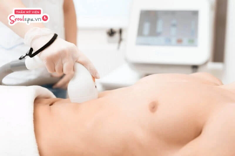 Triệt lông vĩnh viễn Laser giúp làm suy yếu nang lông và loại bỏ lông hiệu quả