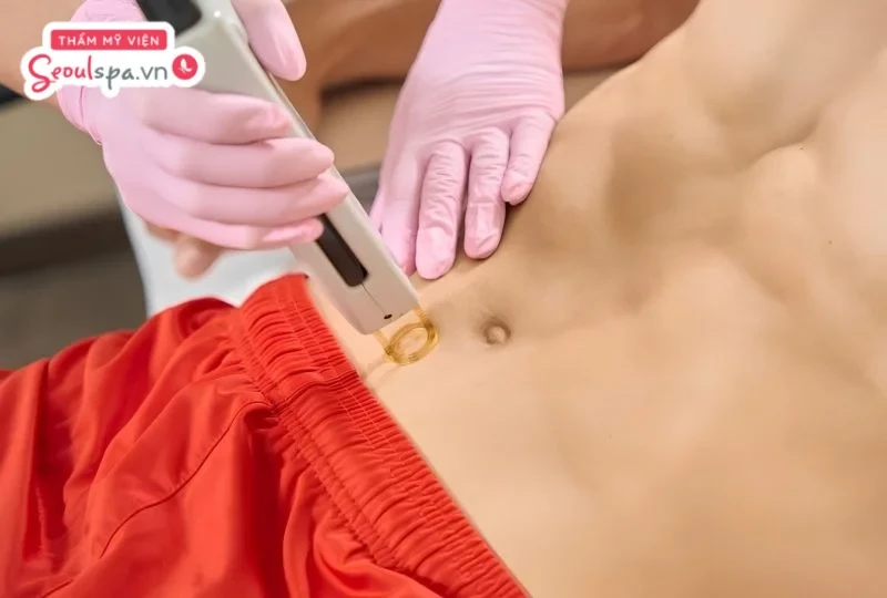 Quy trình triệt lông bụng tại SeoulSpa.vn được thực hiện bài bản qua từng bước, giúp bảo vệ làn da và hỗ trợ tối ưu hiệu quả triệt lông.