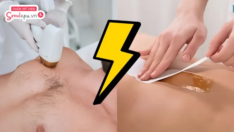 So sánh hiệu quả triệt lông ngực tại nhà và tại spa, cho thấy công nghệ chuyên sâu mang lại hiệu quả lâu dài hơn.