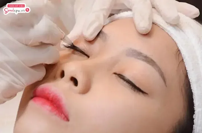 Quy trình thực hiện phun mí đuôi cá cần đảm bảo các yếu tố vô trùng chuẩn y khoa
