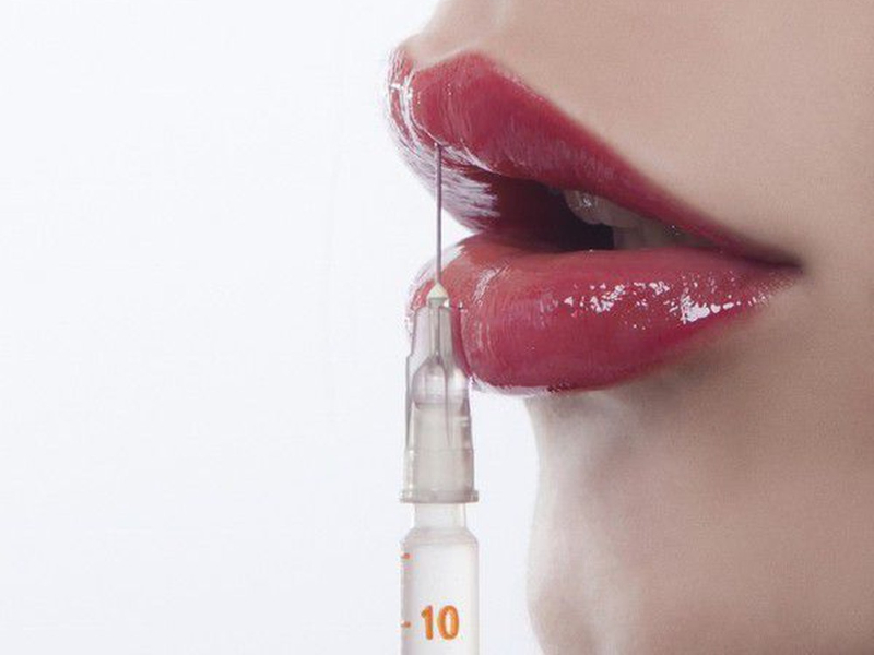 Loại filler sử dụng chất lượng cao sẽ giúp thời gian giữ lâu hơn