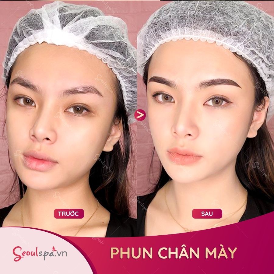 Sợi chân mày khách hàng D.T.Nga bị khuyết và thưa thớt nhiều nơi nhưng sau phun chân mày thì dáng và màu sắc chân mày đã được cải thiện rõ rệt gương mặt sắc nét và cuốn hút hơn.