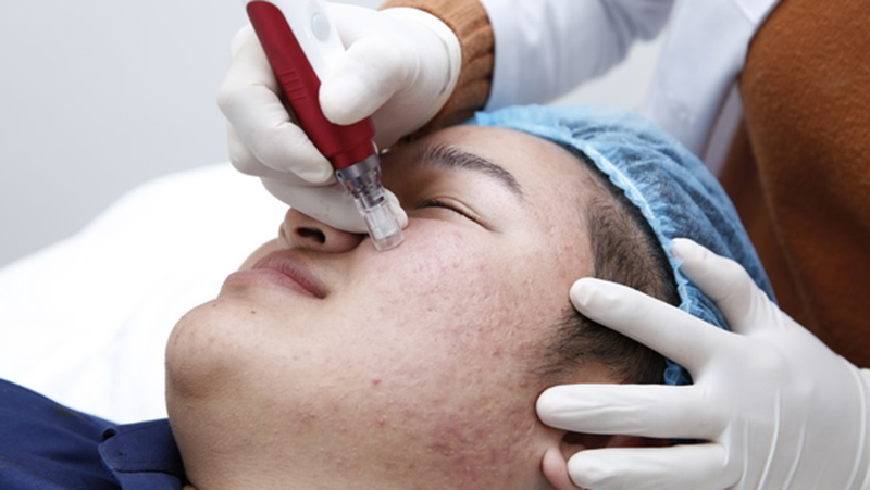 Lựa chọn spa trị mụn chất lượng