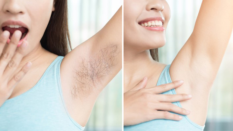 Thời gian triệt lông hợp lý mang lại hiệu quả tốt hơn
