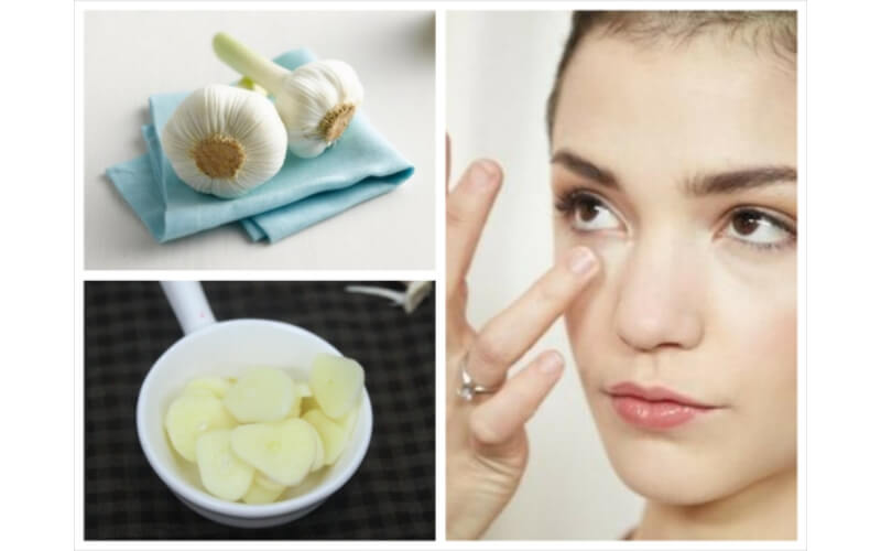 Top 20+ Trẻ Sơ Sinh Nổi Mụn Đầu Trắng Trên Mặt Mí mắt nổi mụn trắng nhỏ có sao không? Có điều trị được không? 30 Milia có phương pháp điều trị hiện đại và tự nhiên