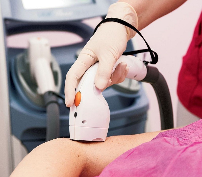 Top 20+ Triệt Lông Vĩnh Viễn Có Tốt Không Triệt lông vĩnh viễn có tốt không – Lợi và hại thế nào? 59 Triệt lông vĩnh viễn còn giúp trị dứt điểm các vấn đề về viêm nang lông