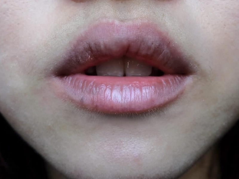 cách làm môi hồng tự nhiên sau 1 đêm