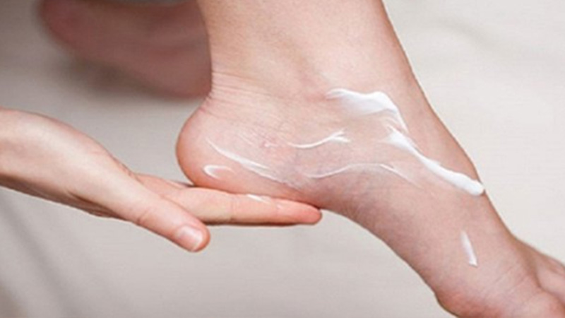 Top 20+ Sau Khi Triệt Lông Nên Bôi Kem Gì Chăm sóc da sau triệt lông vĩnh viễn thế nào là an toàn? 44 Dưỡng ẩm cho da là cách chăm sóc da sau khi triệt lông vĩnh viễn hiệu quả