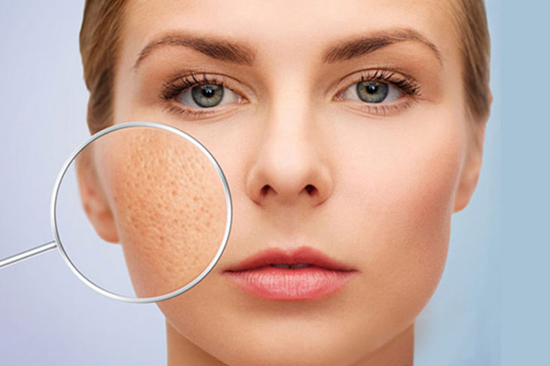 Top 20+ Thuốc Trị Sẹo Xeragel Giá Bao Nhiêu Bôi kem trị sẹo trước hay sau serum để phát HIỆU QUẢ quả tối đa 42 Chọn kem trị sẹo phù hợp có nguồn gốc xuất xứ rõ ràng