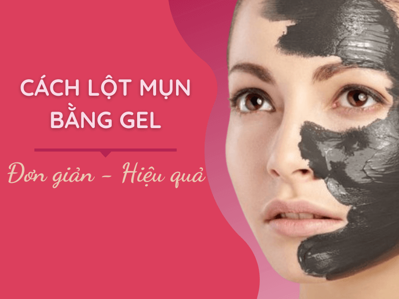 cách lột mụn bằng Gel