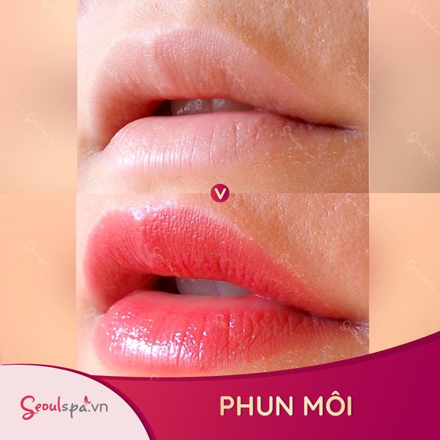 Top 20+ Đẻ Xong Có Được Ăn Chuối Tiêu Không Sau khi phun môi có được ăn chuối không? | SeoulSpa.Vn 24 Kết quả xăm môi Seoul Spa