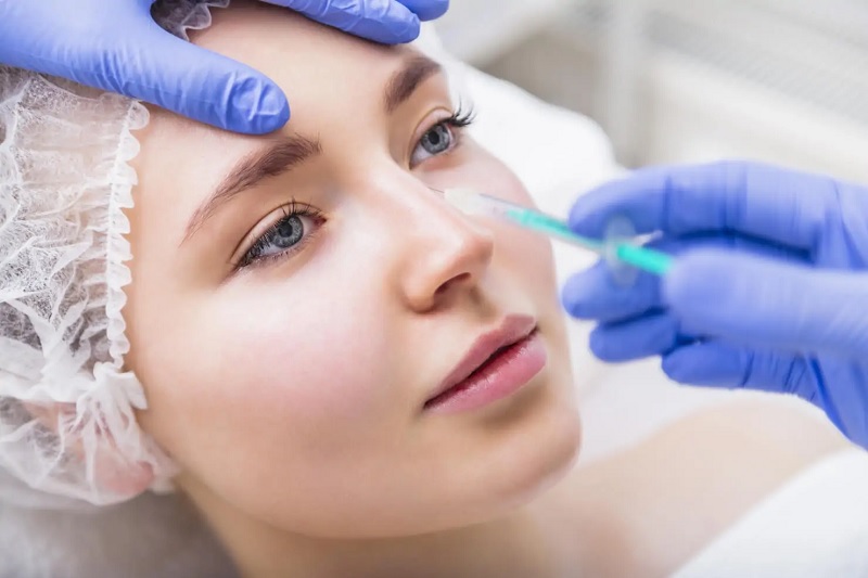 Tiêm filler giúp cải thiện khuyết điểm sóng mũi thấp