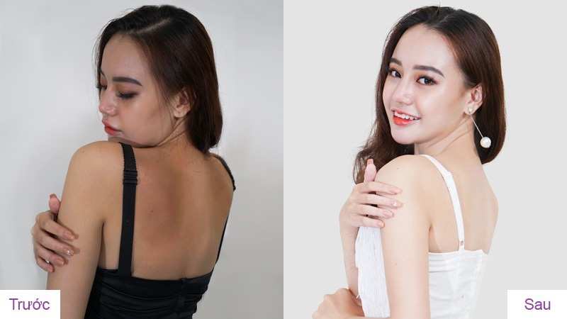Tắm trắng phi thuyền không ăn nắng