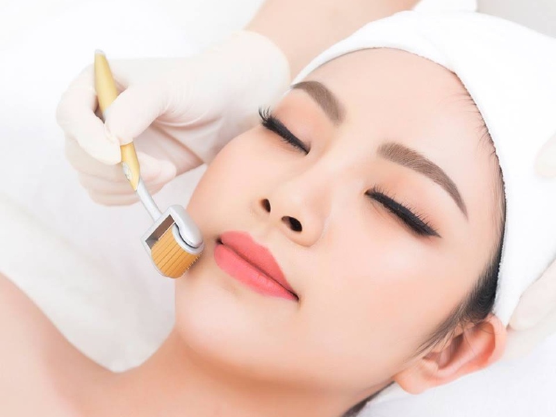 Top 20+ Tế Bào Gốc Trị Thâm Mụn Tốt Nhất Điều trị lăn kim tế bào gốc trị mụn có thực sự hiệu quả không? 32 Lăn kim sẽ giúp làn da được tái tạo và phục hồi nhanh chóng
