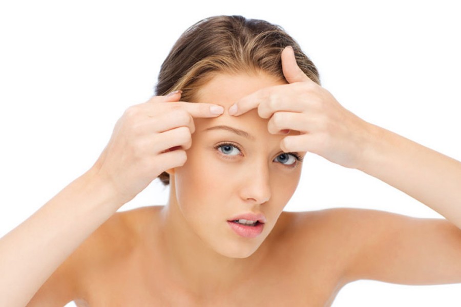 Các bác sĩ khuyên bạn tuyệt đối không nên nặn mụn