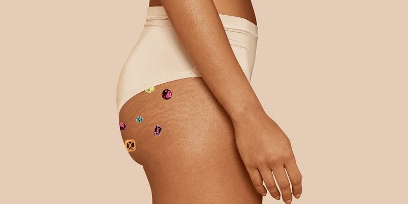 Mụn mông khiến chị em kém tự tin khi diện bikini