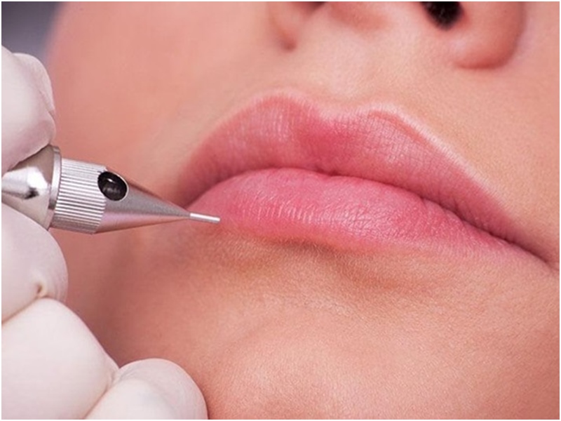 Top 20+ Dấu Hiệu Của Phun Môi Bị Nhiễm Trùng Xăm môi bị nhiễm trùng nguyên nhân và khắc phục như thế nào? 37 Điều gì gây ra nhiễm trùng hình xăm môi?