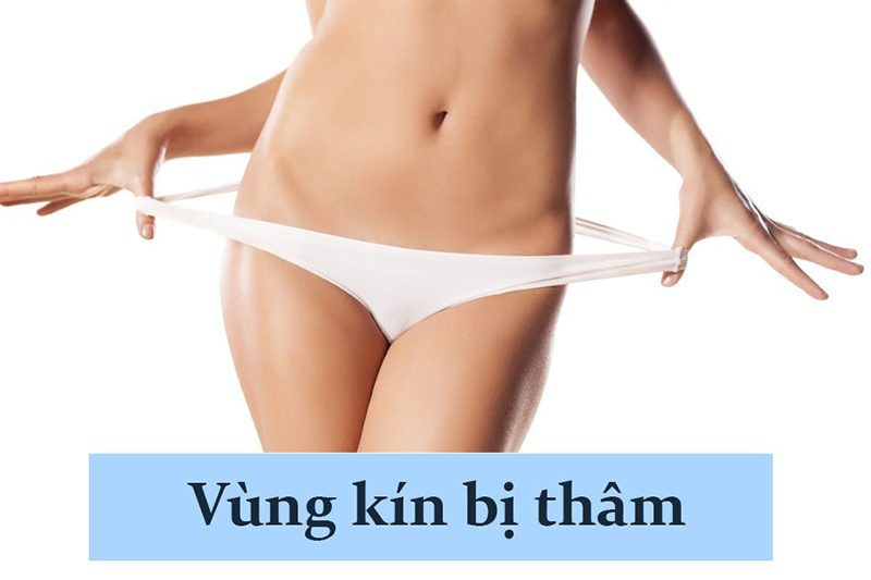 Top 20+ Se Khít Vùng Kín Bằng Laser Có Hiệu Quả Không Làm hồng cô bé bằng laser có an toàn không? Quy trình thực hiện 25 Cô bé bị thâm đen do các nguyên nhân khác nhau