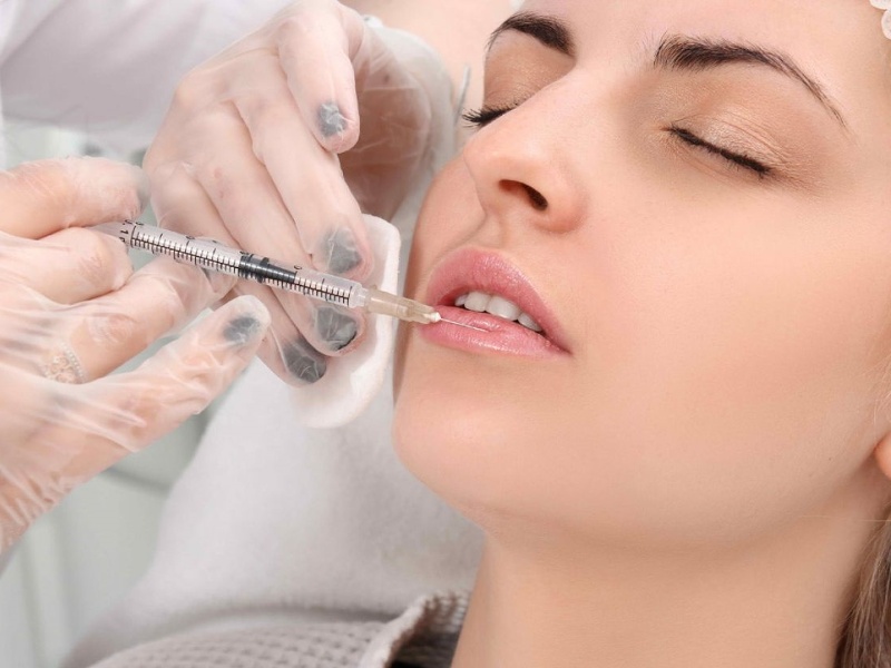 Tiêm filler giúp cải thiện vóc dáng gương mặt, đem lại sự đầy đặn, trẻ trung
