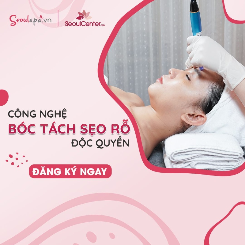 Top 20+ Mặt Bị Rỗ Có Chữa Được Không “Tuyệt chiêu” giúp phục hồi da mặt bị rỗ hiệu quả | SeoulSpa.Vn 68 Địa chỉ spa tái tạo da mặt bị rỗ - Thẩm mỹ viện Seoul Spa