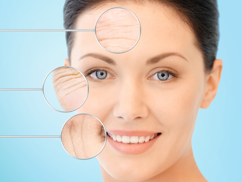 Phương pháp tiêm botox hoàn toàn không xâm lấn, không gây đau đớn
