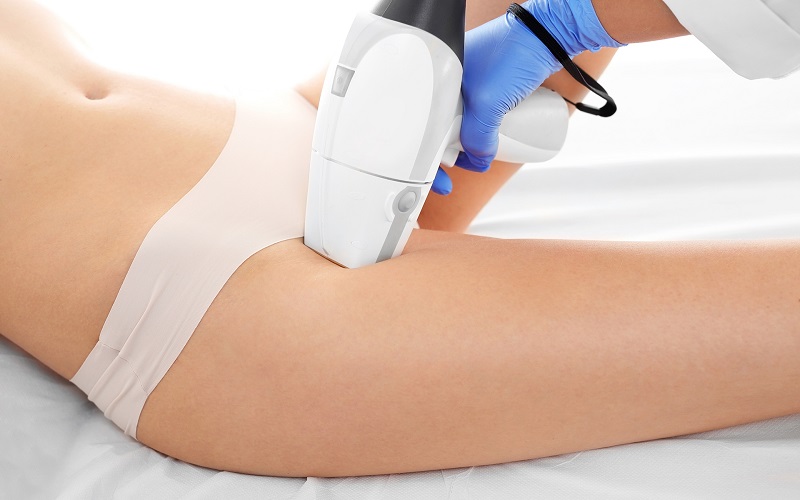 Top 20+ Trị Rạn Da Bằng Laser Bao Nhiêu Tiền Trị rạn da bằng laser bao nhiêu tiền? Có hiệu quả không? 27 Chi phí điều trị rạn da bằng laser thay đổi tùy theo nhu cầu