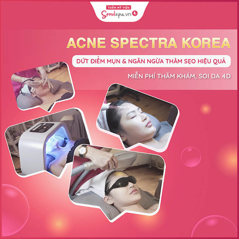 Trị mụn bằng công nghệ Acne Spectra Korea