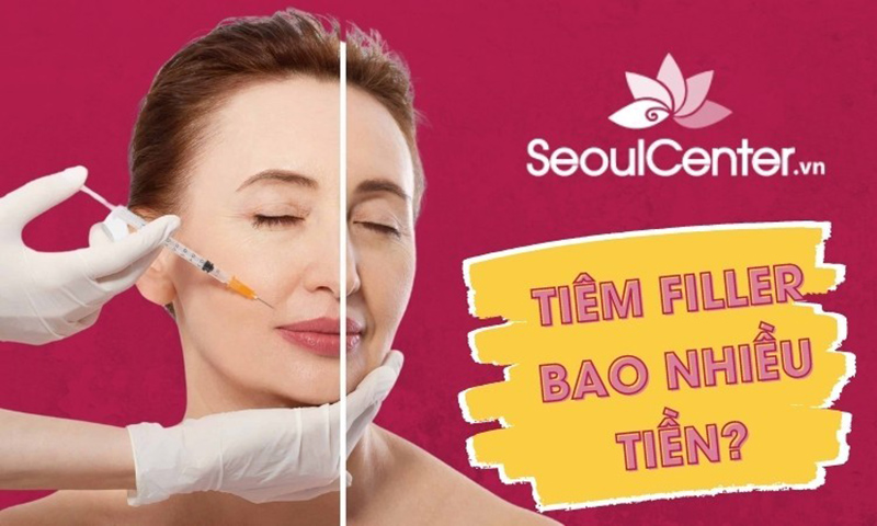 Tiêm filler làm đẹp tốn mức chi phí bao nhiêu?