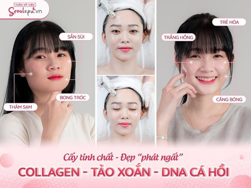 Sở hữu làn da trắng sáng, tươi trẻ với chi phí phải chăn