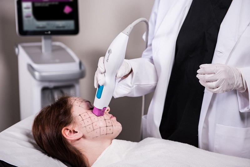 Sau khi thực hiện công nghệ trẻ hóa da Thermage đã khắc phục mọi dấu hiệu lão hóa da