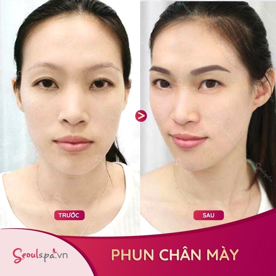 Chị N.T.Trang có chân mày ban đầu mờ nhạt không rõ nét mày, sau 20 phút phun chân mày, chị đã sở hữu đôi mày cực kì sắc nét, rõ dáng giúp gương mặt tươi tắn và trẻ trung hơn