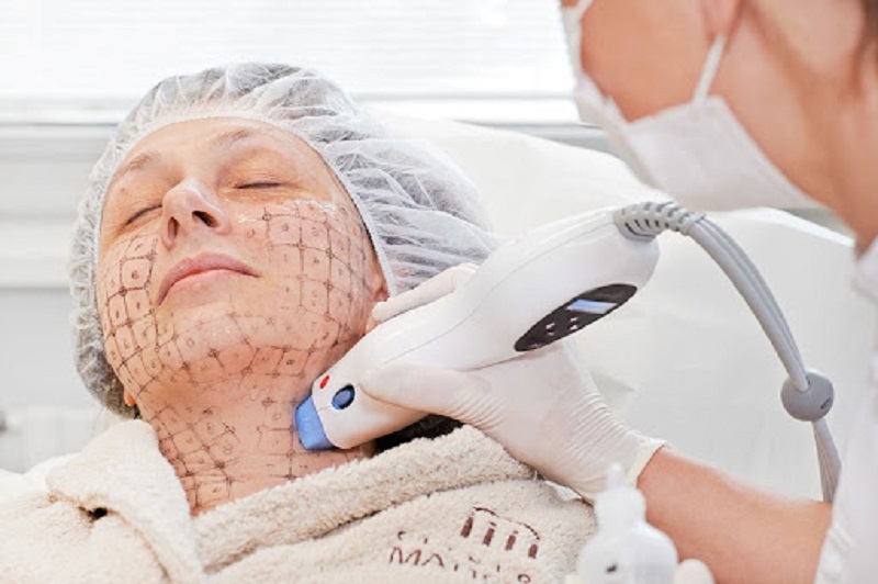 Tác động của bước sóng RF không gây hại cho da mà ngược lại rất an toàn, mang nhiều lợi ích cho da