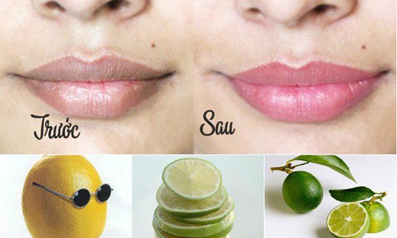 Trị thâm và khô môi bằng chanh mang lại hiệu quả tích cực