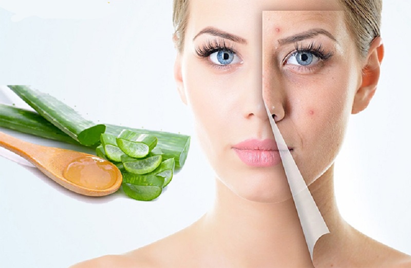 Mặt nạ nha đam giúp giảm mụn và làm sáng da hiệu quả
