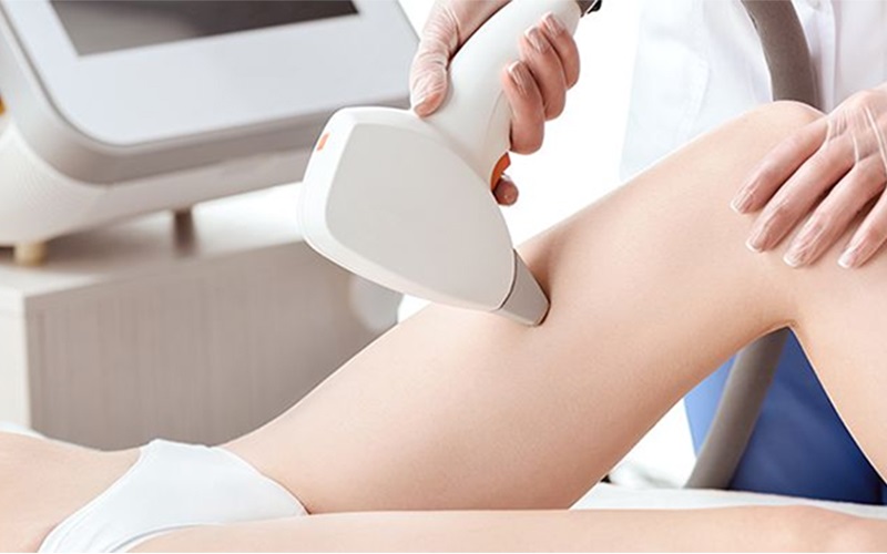 Quy trình triệt lông chuẩn Y Khoa
