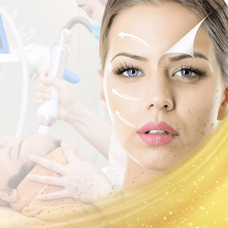 Trẻ hóa da nhờ công nghệ căng chỉ collagen