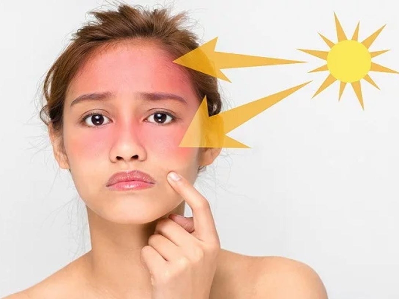 Tác động từ ánh nắng Mặt Trời