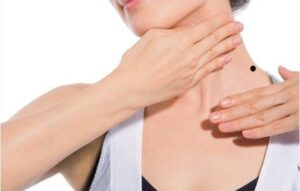 Nốt ruồi trên vai phải có ý nghĩa gì trong nhân tướng học? 7 Tỏi có tác dụng làm mờ nốt ruồi nhanh chóng