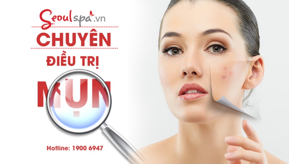 Top 20+ Làm Cách Nào Để Hết Mụn Trên Trán Mụn ở trán biểu hiện bệnh gì? Các biện pháp điều trị hiệu quả 24 Seoul Spas - Địa Chỉ Tin Cậy Cho Dịch Vụ Điều Trị Mụn Công Nghệ Cao